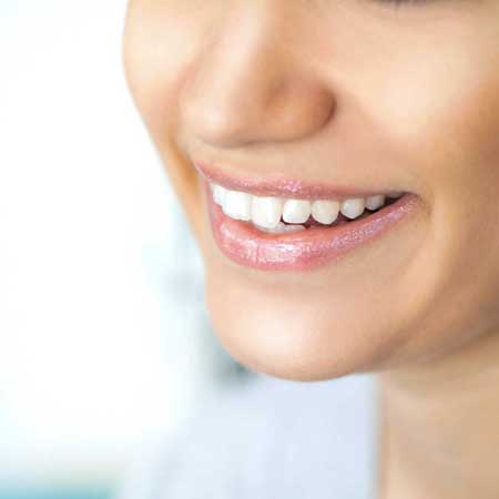 teeth whitening