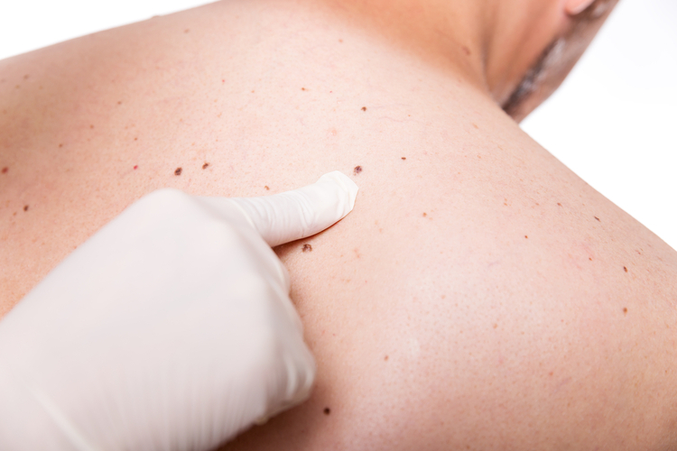 Skin Health Dr. Ono Alex Ohunyon