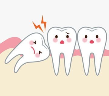 Wisdom Teeth Removal 1