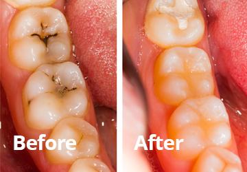 windsor dentist