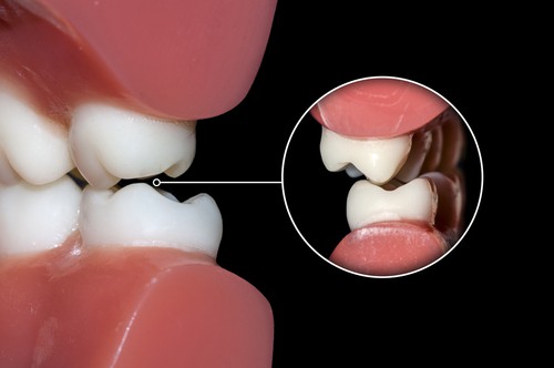 Aardent Dental Center 3