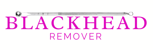 blackheadremover