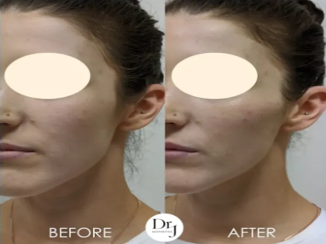 Aesthetic Treatments